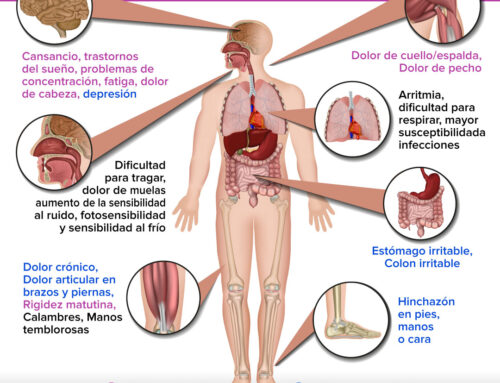 ¿Cómo confirmo que padezco fibromialgia?
